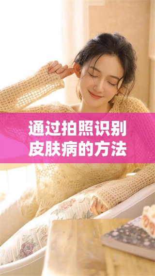 通过拍照识别皮肤病的方法你了解吗？让我们一起来探讨这个话题吧！